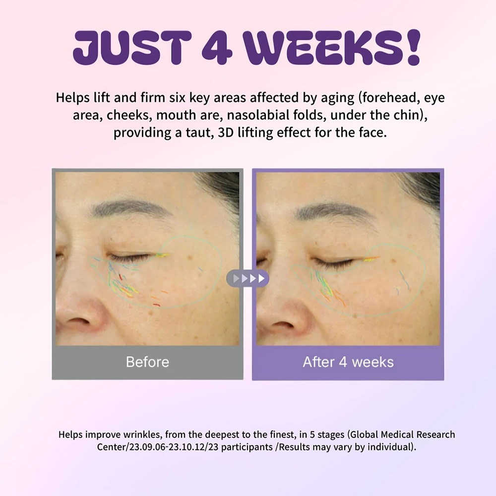 CENTELLIAN24 360 Shot Salmon PDRN Active Serum Ser de fata cu PDRN derivat din somon- hidratare si fermitate, 50 ml