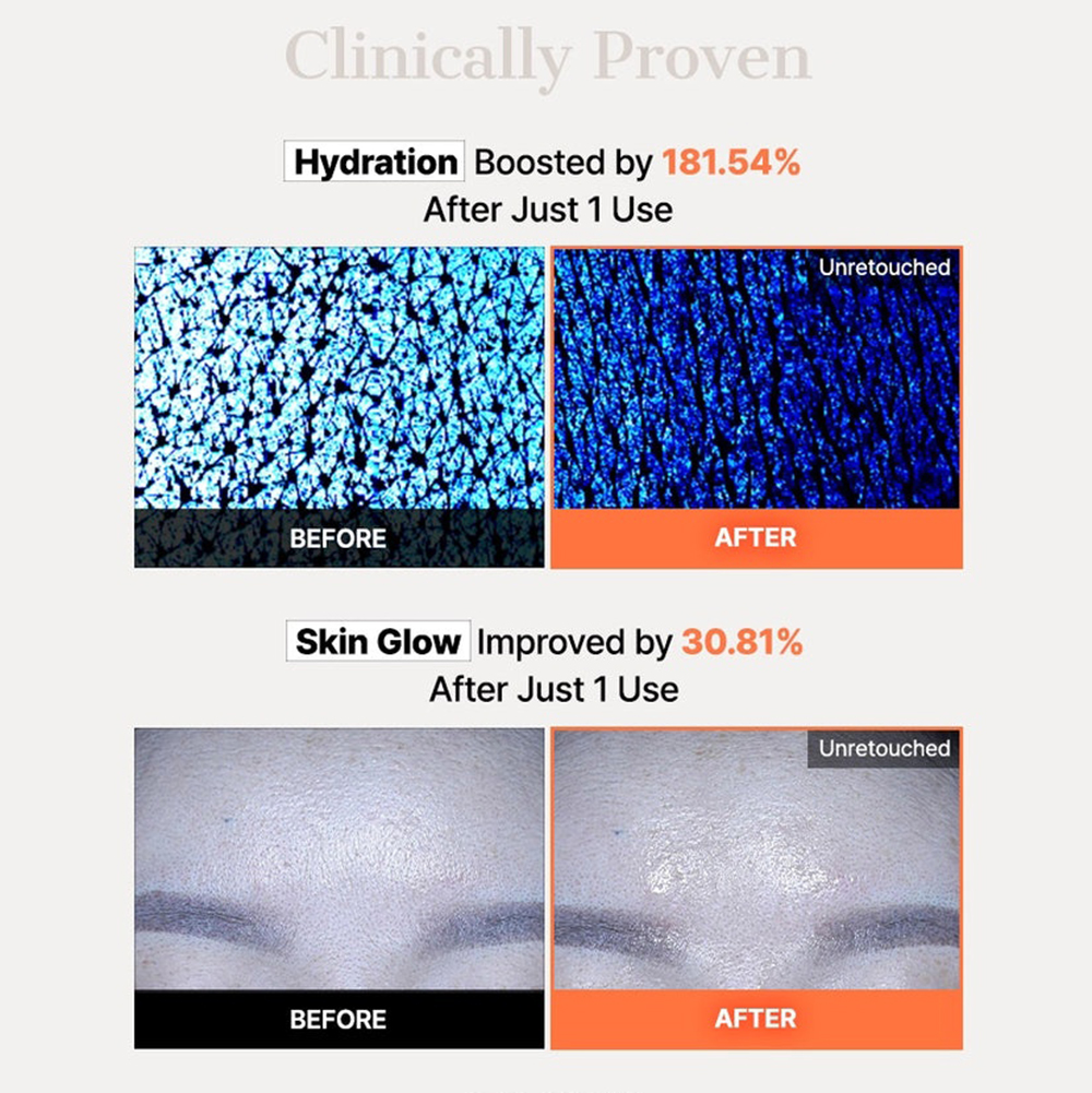 5 PDRN Hyaluronic Acid Vital Hydrating Hydrogel Mask Masca de fata 34 gr