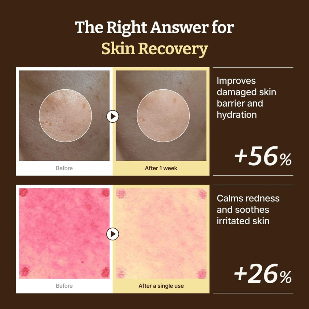 DR.REJU-ALL Advanced PDRN Rejuvenating Cream - crema de fata formulata cu PDRN si niacinamida, care contribuie la sustinerea regenerarii pielii si la imbunatatirea aspectului general al tenului - 20 ml