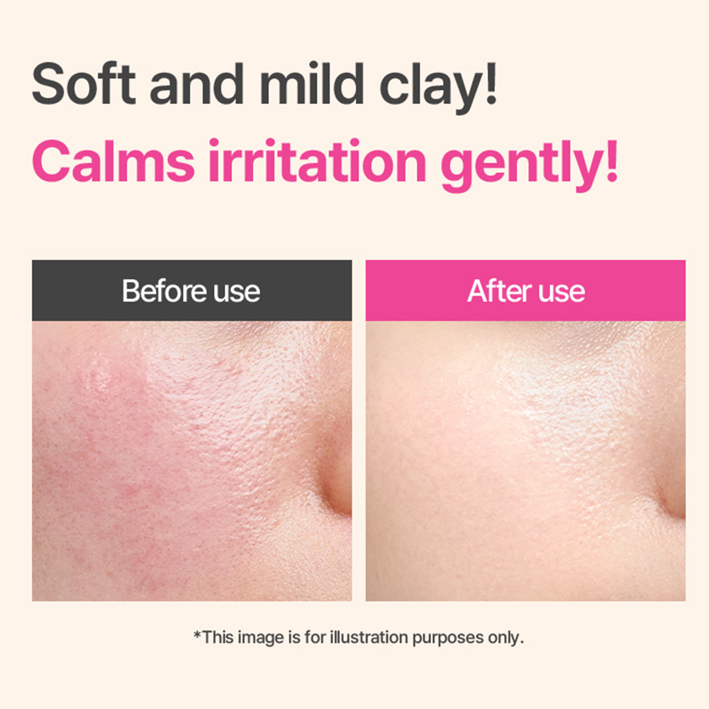 I'M FROM Beet Purifying Mask 70 gr - Masca de fata formulata cu sfecla rosie si argila, care contribuie la curatarea porilor, la controlul excesului de sebum si la indepartarea celulelor moarte