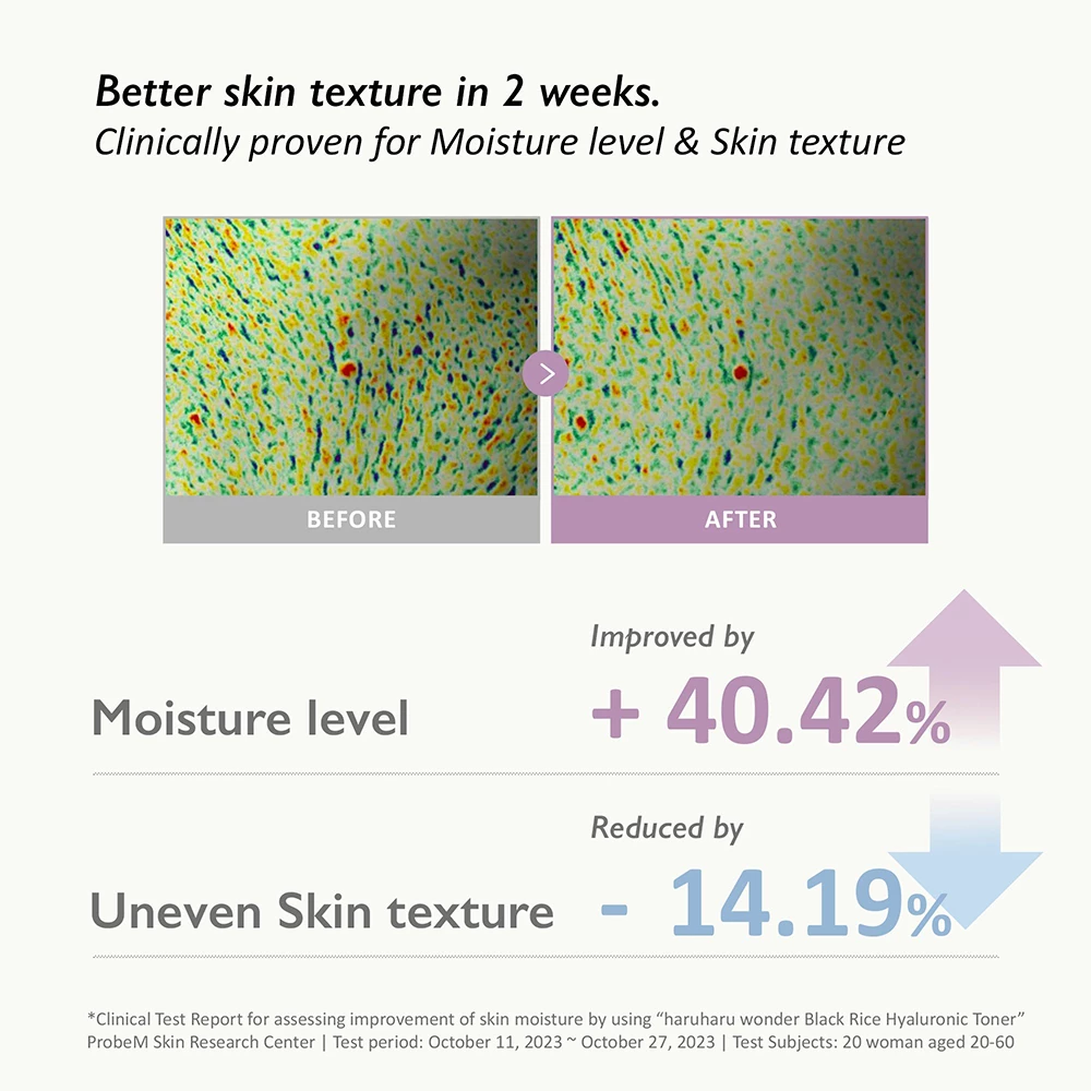 HARUHARU WONDER Black Rice Hyaluronic Toner Toner de fata - hidratare si elasticitate, 300 ml