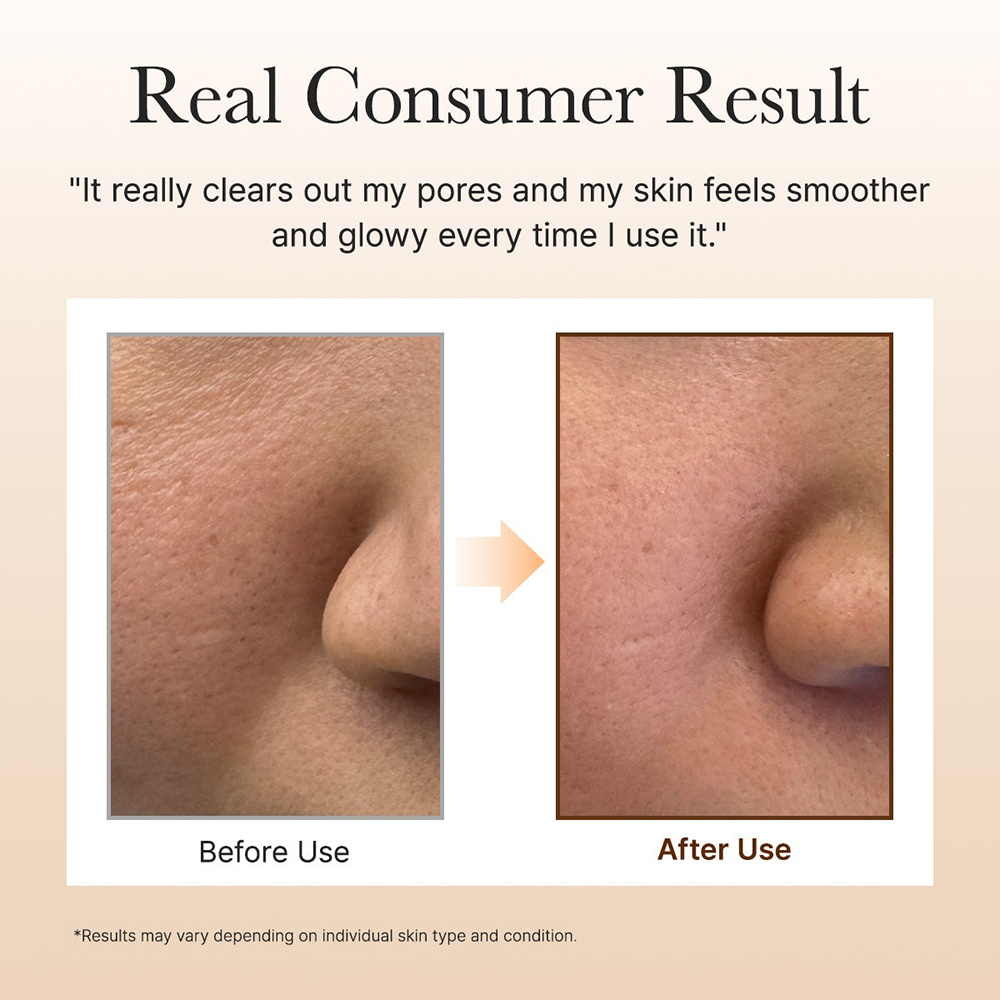 ARENCIA Calendula Rice Mochi Cleanser, 120 gr - balsam de curatare formulat cu extract de calendula si pudra de orez, care contribuie la curatarea zilnica a tenului sensibil, uscat sau cu textura neuniforma si la metinerea confortului dupa clatire
