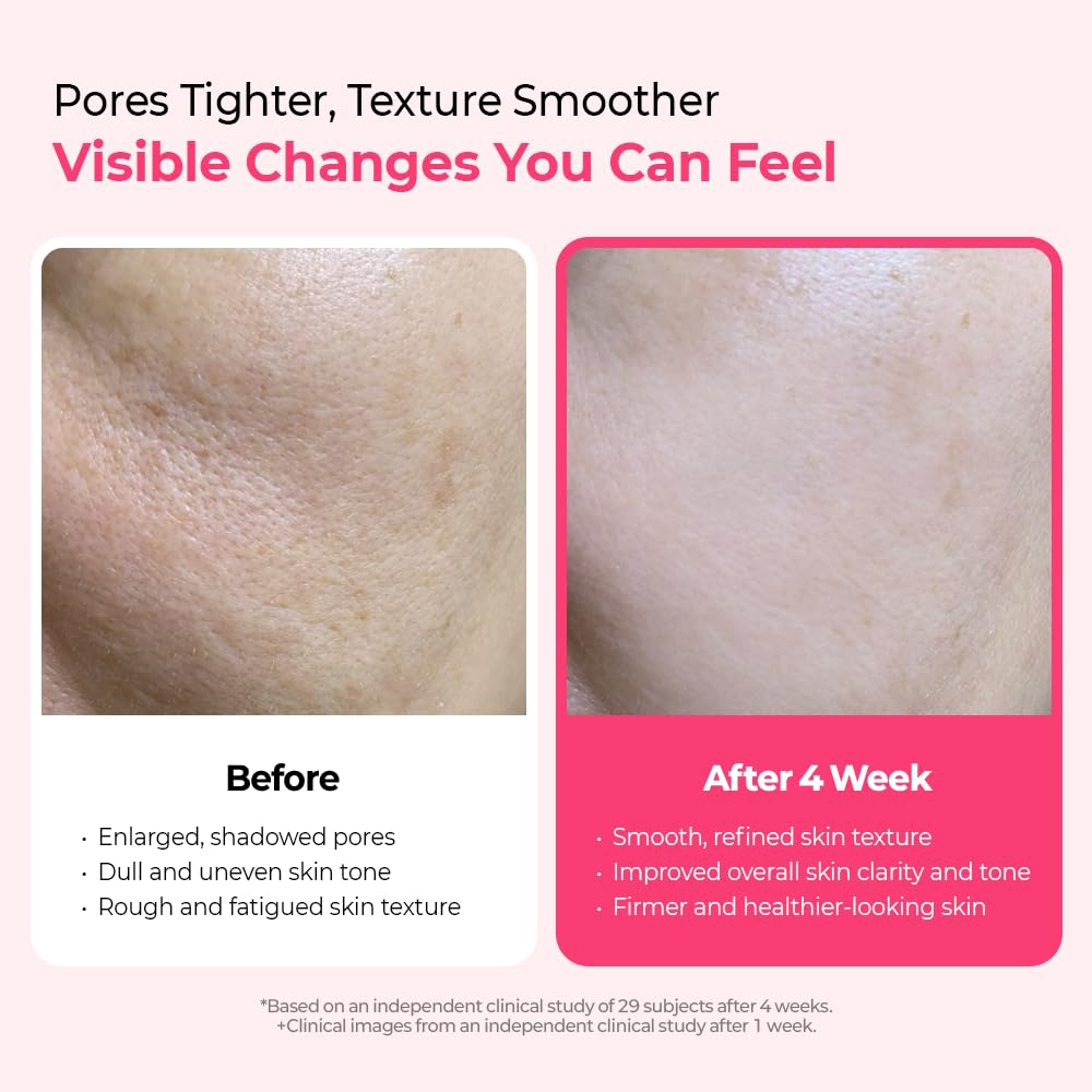 Cemenrete Cyano Pink Spicule Serum Ser de fata cu microace 30 ml