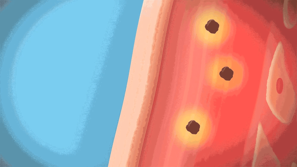 ACROPASS Dark Spot Care 6 Patches - plasturi formulati cu niacinamida si vitamina C, care contribuie la reducerea hiperpigmentarii pielii - 6 buc