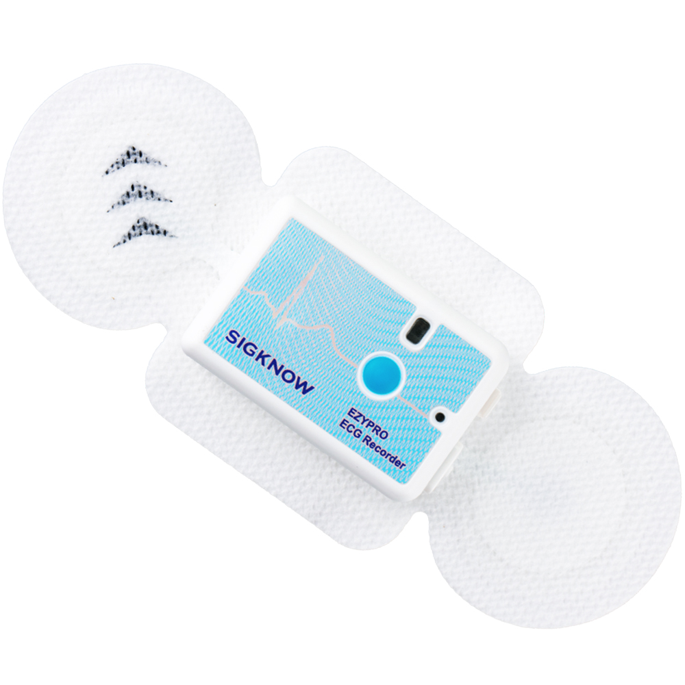 ECG Recorder EZYPRO UG02, Dispozitiv Holter fara fire Wireless de Monitorizare Cardiaca ECG / EKG timp de 14 zile, Rezistent la apa, inclus Analiza si Raport Medical, cantareste doar 19 gr
