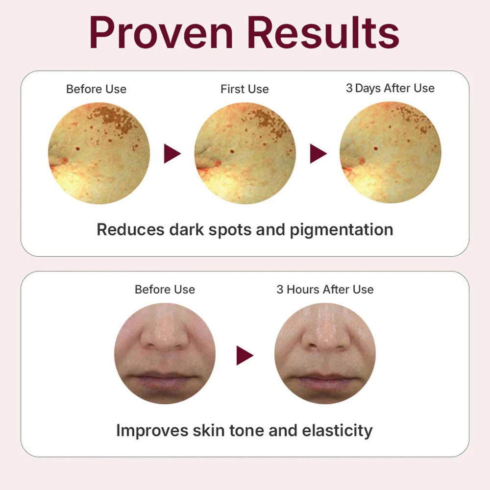 CENTELLIAN24 Expert Madeca Mela Capture Ampoule Max ser de fata - luminozitate si uniformitate, 3 x 15 ml