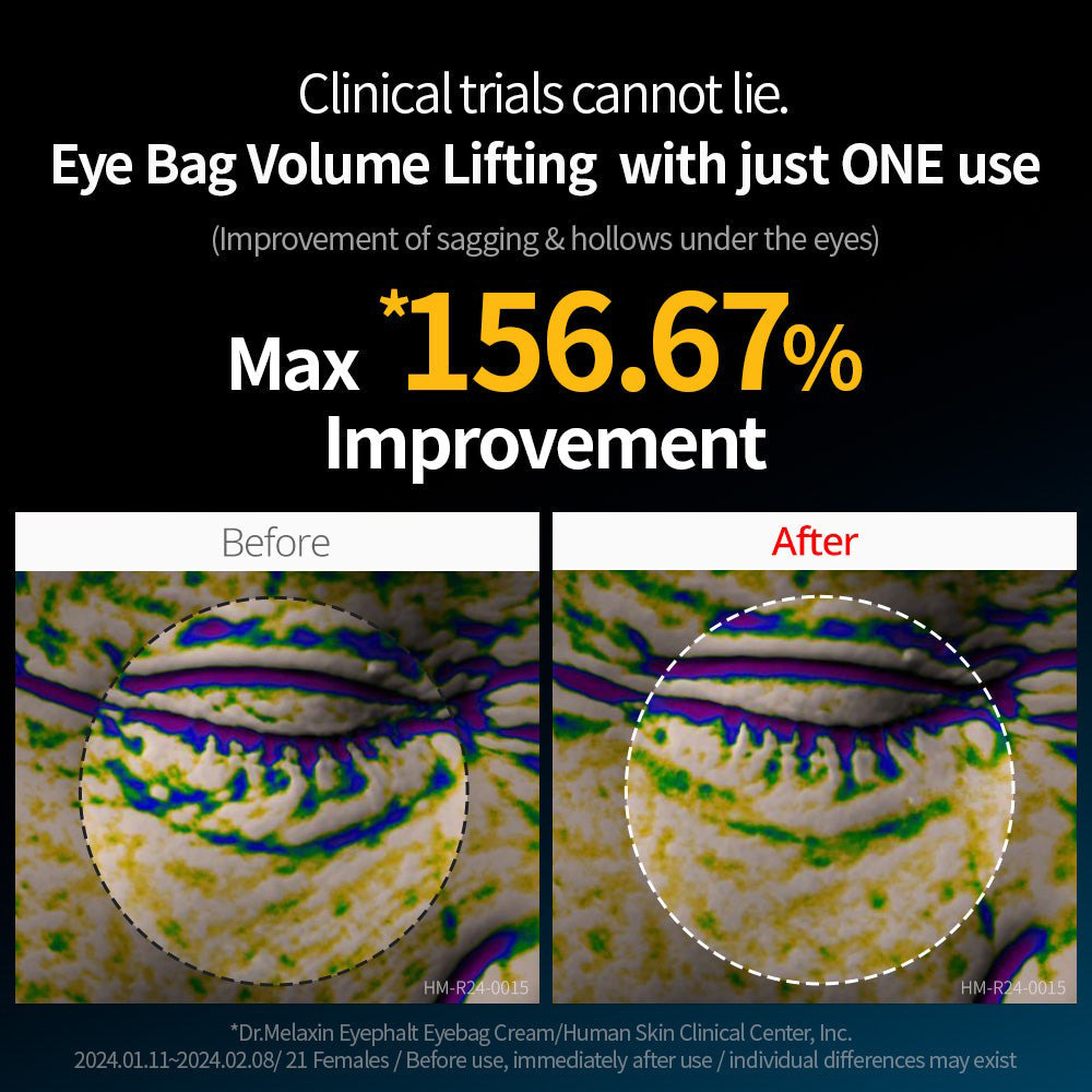 EYEPHALT Eye Bag Cream Crema contur ochi anti-cearcane 10 ml