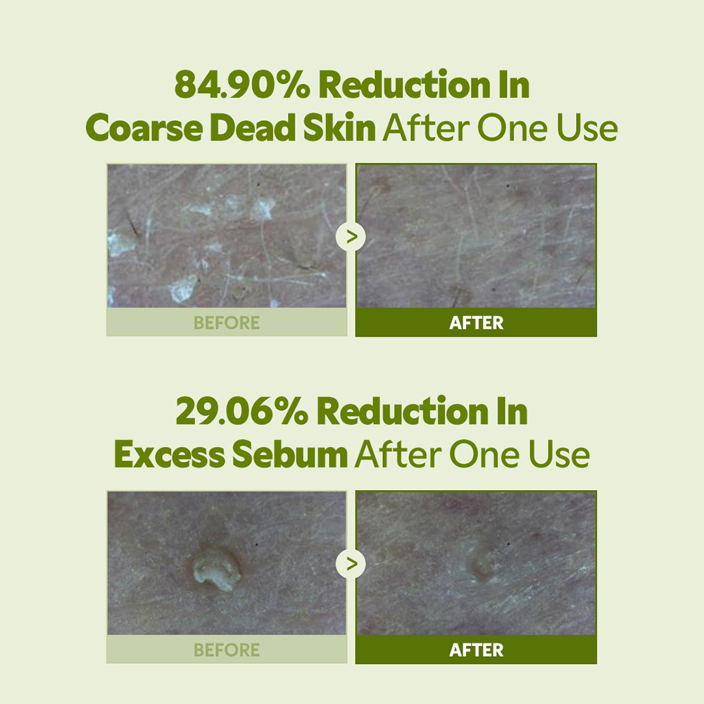 TIRTIR Matcha Bubble Tea Scrub, 95gr - exfoliant formulat cu acid salicilic si gluconolactona, care contribuie la exfolierea delicata si la ingrijirea zonelor cu exces de sebum sau aspect aspru