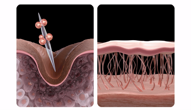 Necklinephalt Neck Cream Crema de fata si gat 20 ml