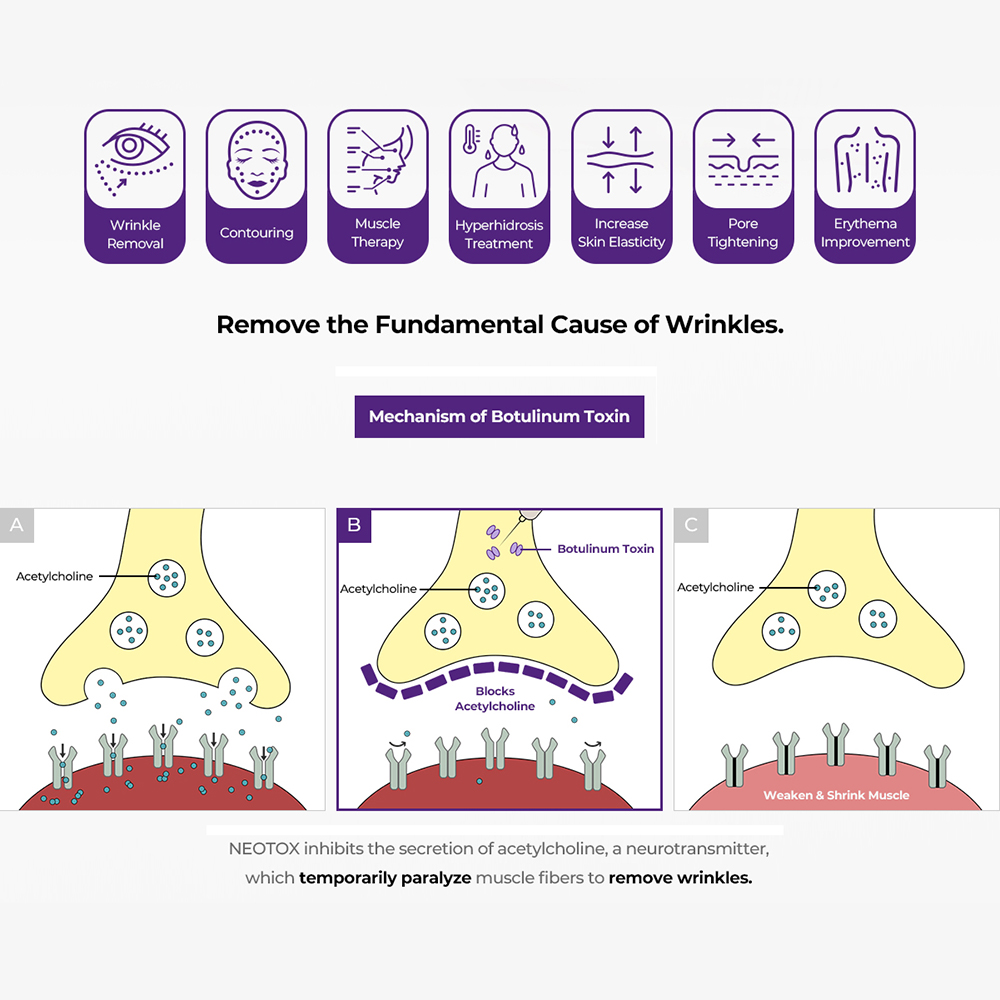 NEOTOX 100U Crema Type A