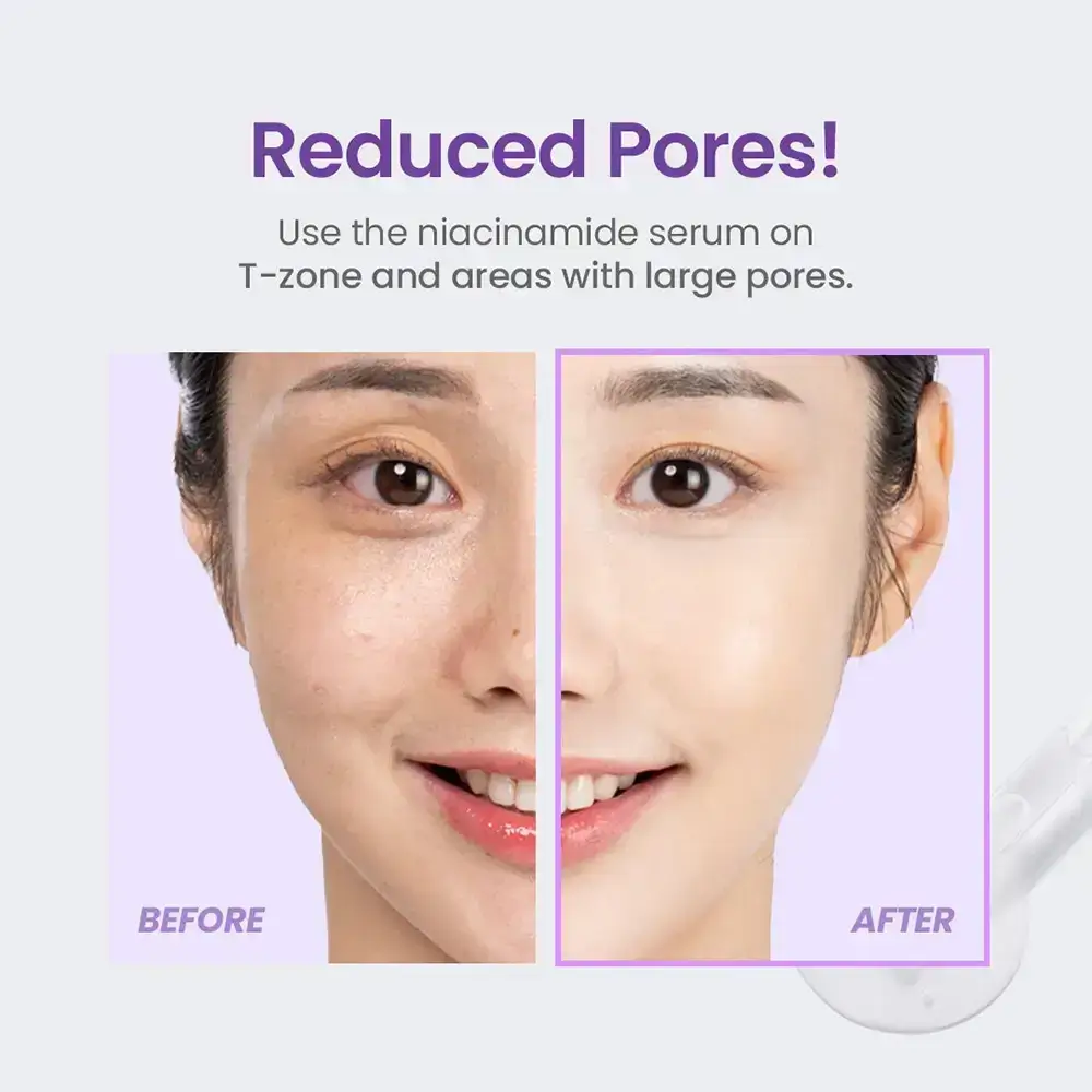 TIRTIR Niacinamide Collection Ser de fata Niacinamide 20% - Antirid, Iluminator si Uniformizare Ten, 30 ml