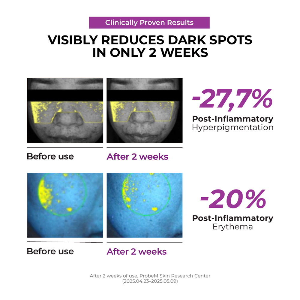JUMISO Niacinamide 20 Serum ser pete pigmentare - luminozitate si uniformizare, 40 ml