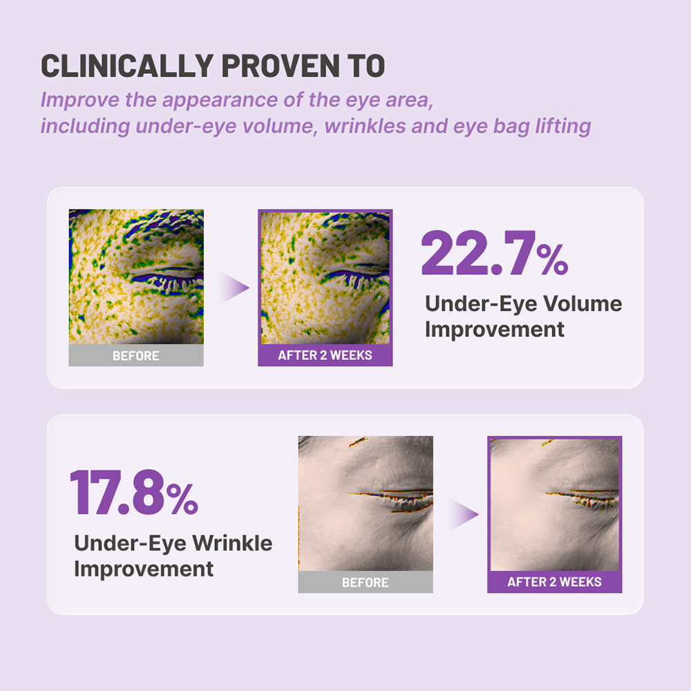 JUMISO Niacinamide 5+ Depuffing Under-Eye Patches 10 gr - Plasturi pentru ochi formulati cu niacinamida si cafeina, care contribuie la diminuarea aspectului pungilor de sub ochi si al cearcanelor