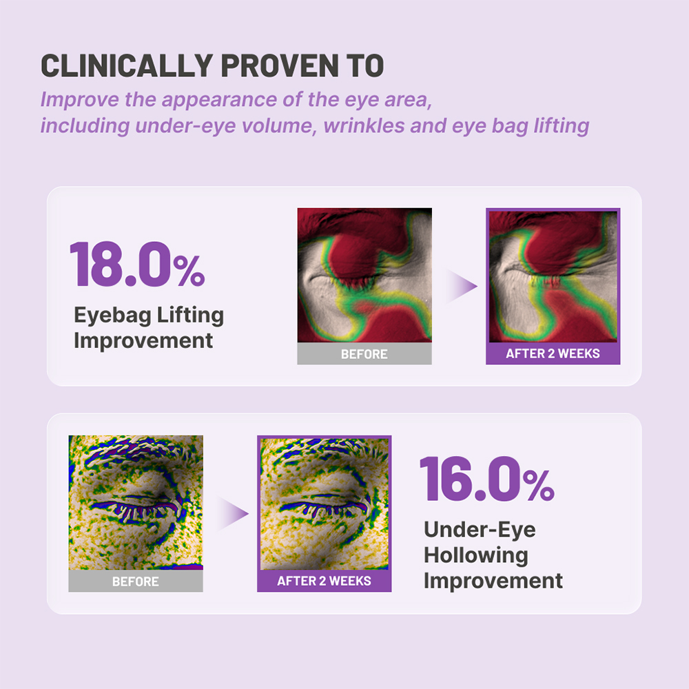 JUMISO Niacinamide 5+ Depuffing Under-Eye Patches 10 gr - Plasturi pentru ochi formulati cu niacinamida si cafeina, care contribuie la diminuarea aspectului pungilor de sub ochi si al cearcanelor
