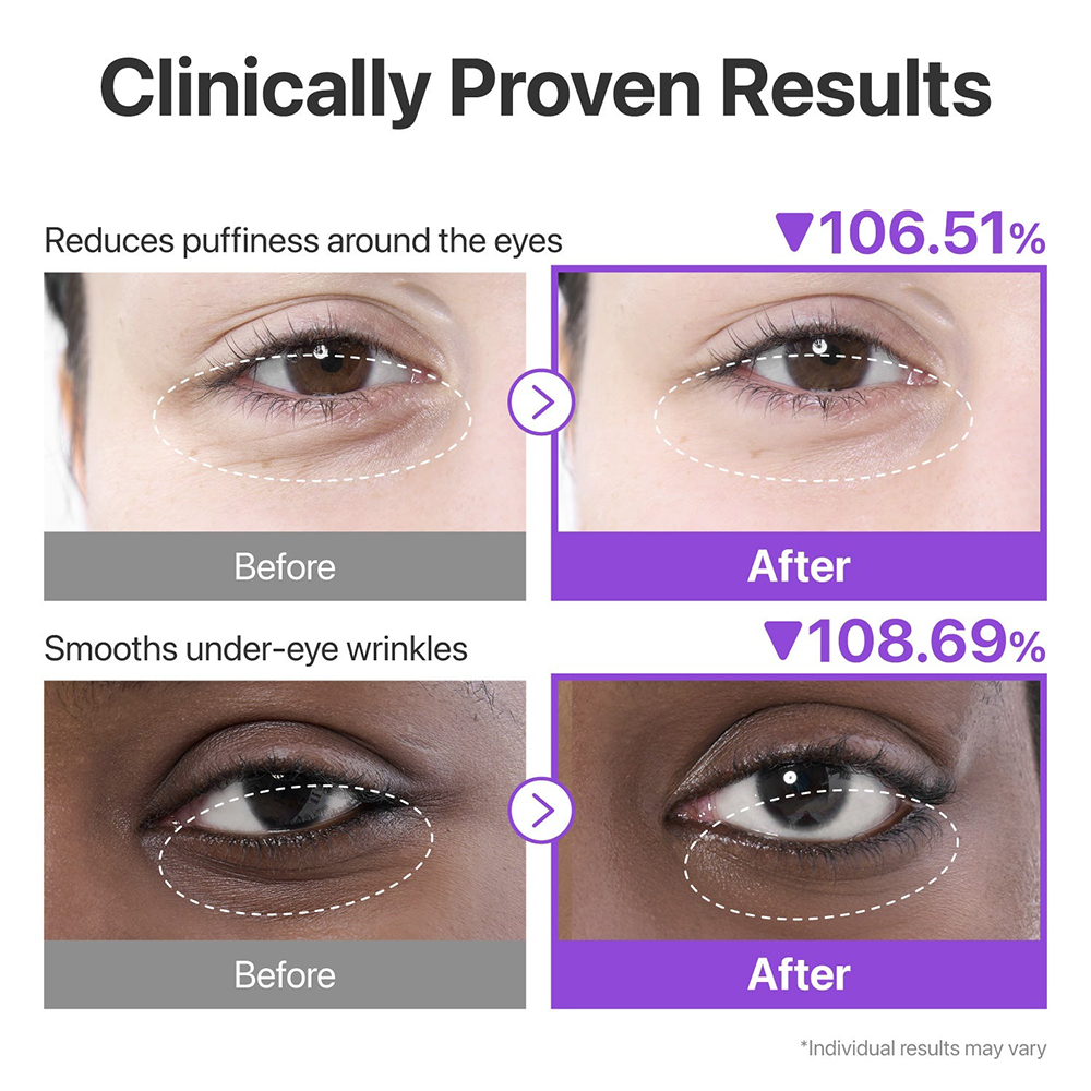 No.9 NAD+Collagen Under Eye Patches Benzi pentru ochi 5 buc