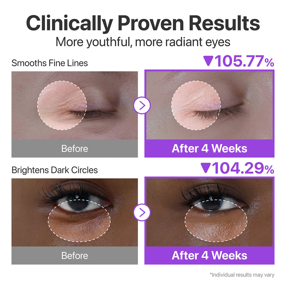 No.9 NAD+Retinol Volumetox Eye Cream Crema contur ochi 10 ml