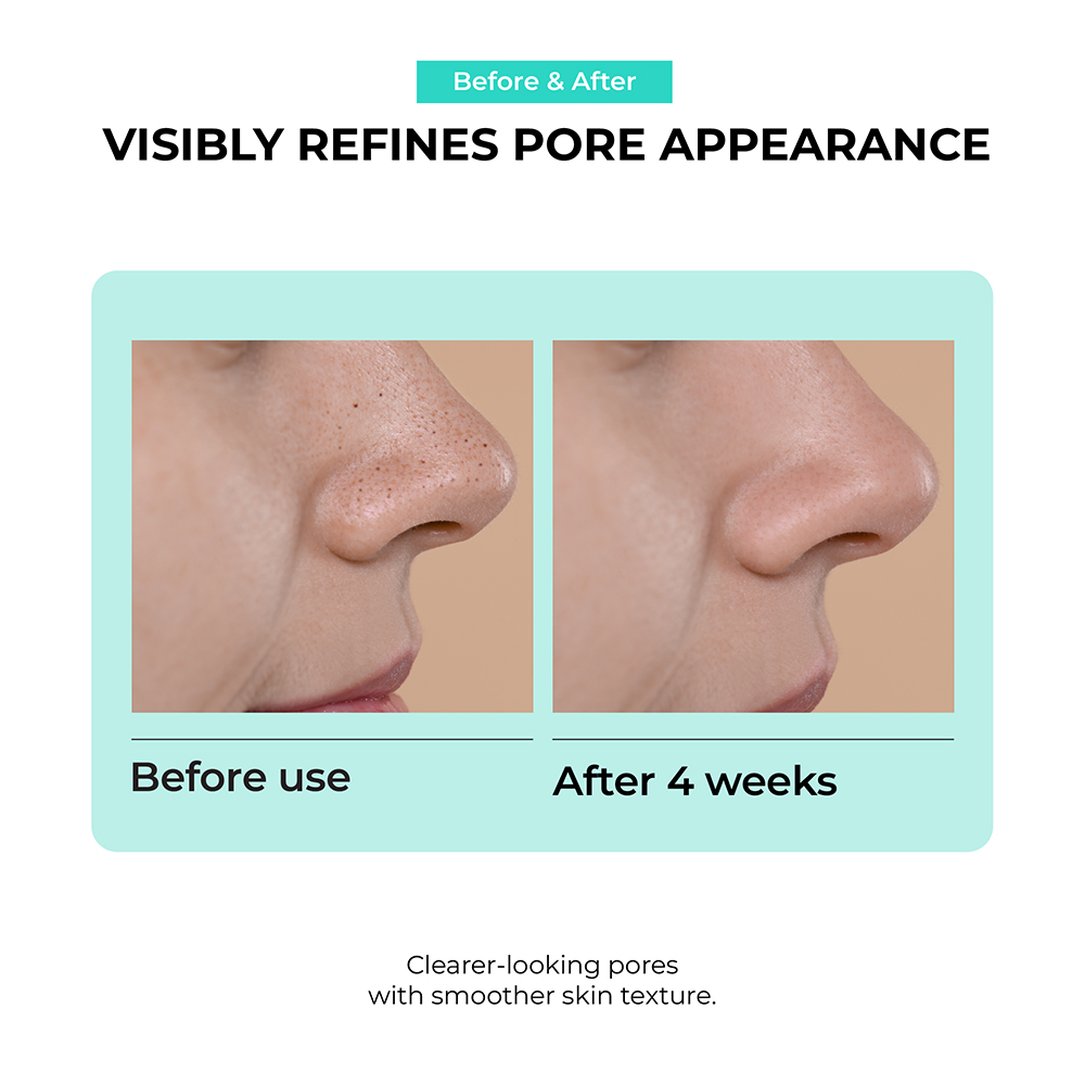 JUMISO Overnight Zero Pore Nose Patch - Plasturi formulati cu LHA si colagen, care contribuie la absorbtia excesului de sebum si la mentinerea porilor mai curati timp de 4-8 ore