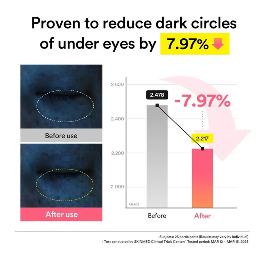 ABIB PDRN Retinal Eye Patch Glow Jelly benzi pentru ochi - hidratare si luminozitate, 60 buc