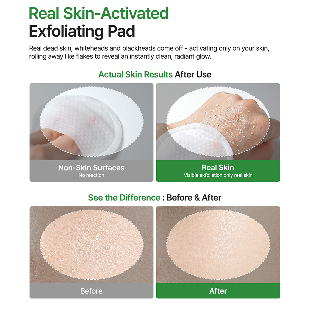 Peel Shot Exfoliating Pad Dischete exfoliante 8 buc