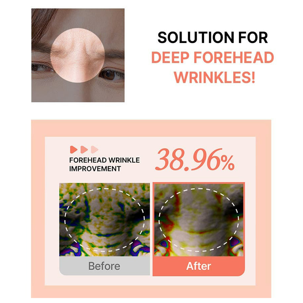 ACROPASS Reti-Rn Microcone Patch T-Shape - plasturi formulati cu retinol si PDRN, care contribuie la ingrijirea ridurilor si la imbunatatirea fermitatii pielii - 4 buc