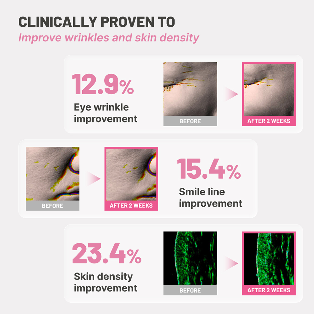 JUMISO Retinal 0.1 PDRN 5000 Cream 50 ml - Crema de fata formulata cu retinal si PDRN, care contribuie la imbunatatirea aspectului ridurilor, al porilor dilatati si al pierderii fermitatii