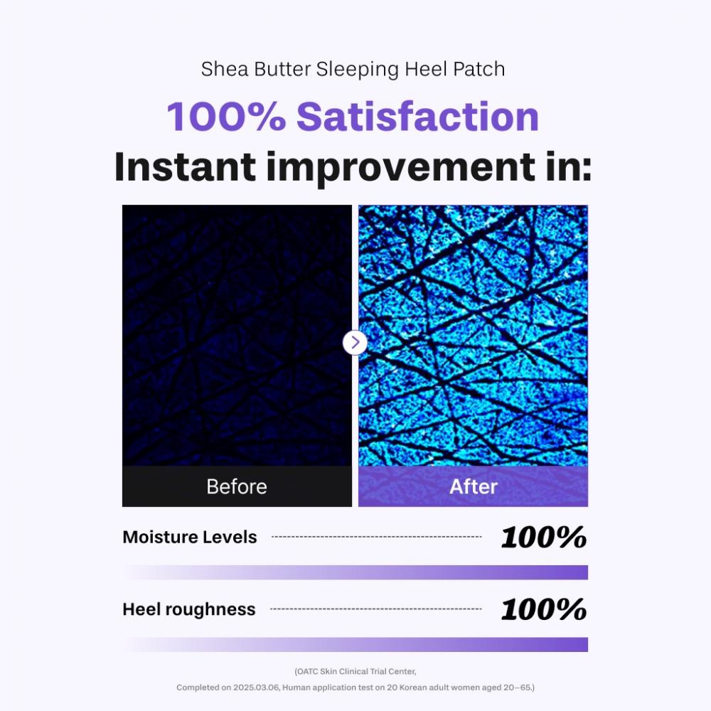 BAREN Shea Butter Sleeping Heel Patch, 2 buc - benzi pentru talpi formulate cu shea butter si acid hialuronic, care contribuie la hidratarea calcaielor uscate si la mentinerea confortului pielii pe timpul noptii