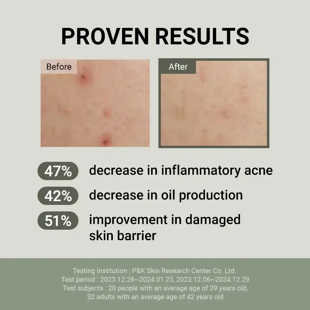 Jumiso Snail Mucin 88 + Peptide Crema pentru fata - Hidratare intensiva si regenerare, 100 ml