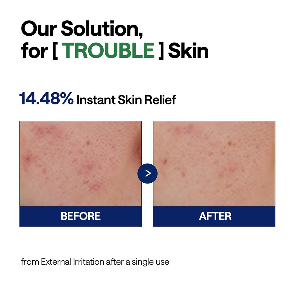 Teatree Calming Hydra Serum Ser de fata 40 ml