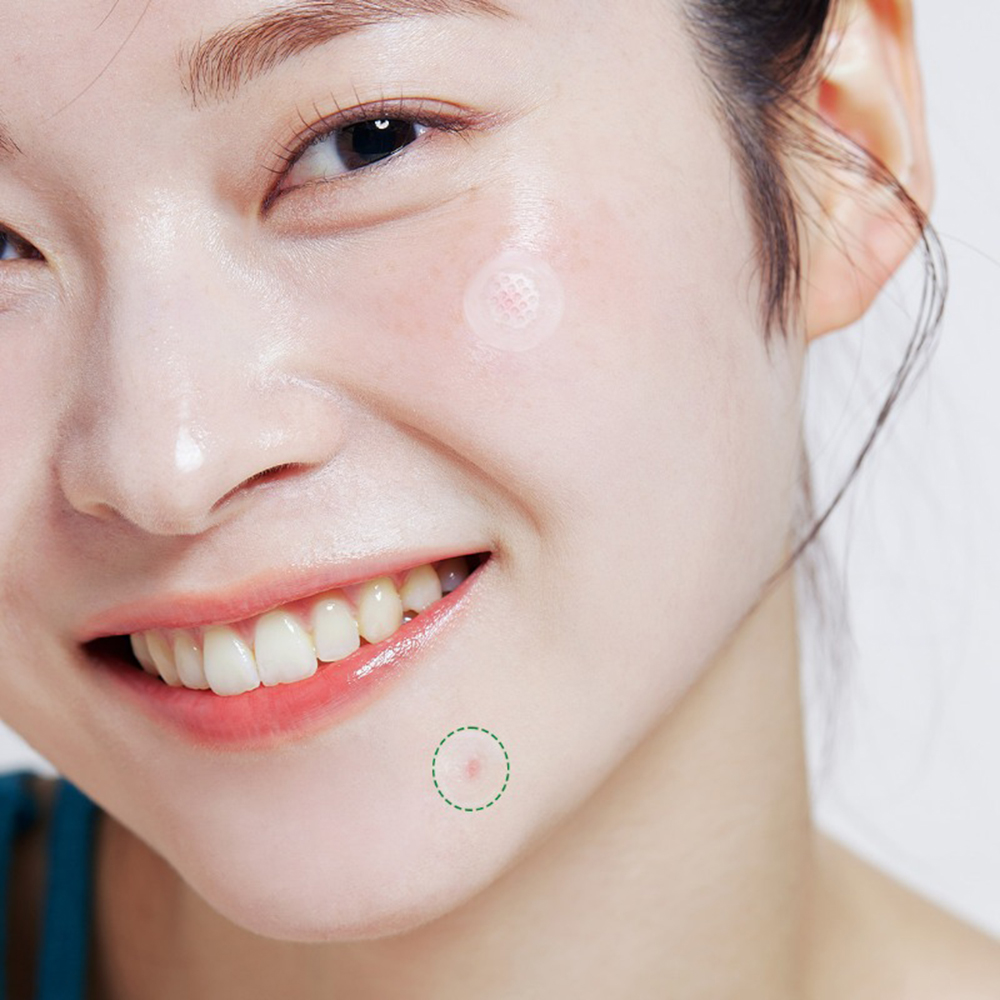 Trouble Care Microcone Patch Small Plasturi cu micro-ace 9 buc