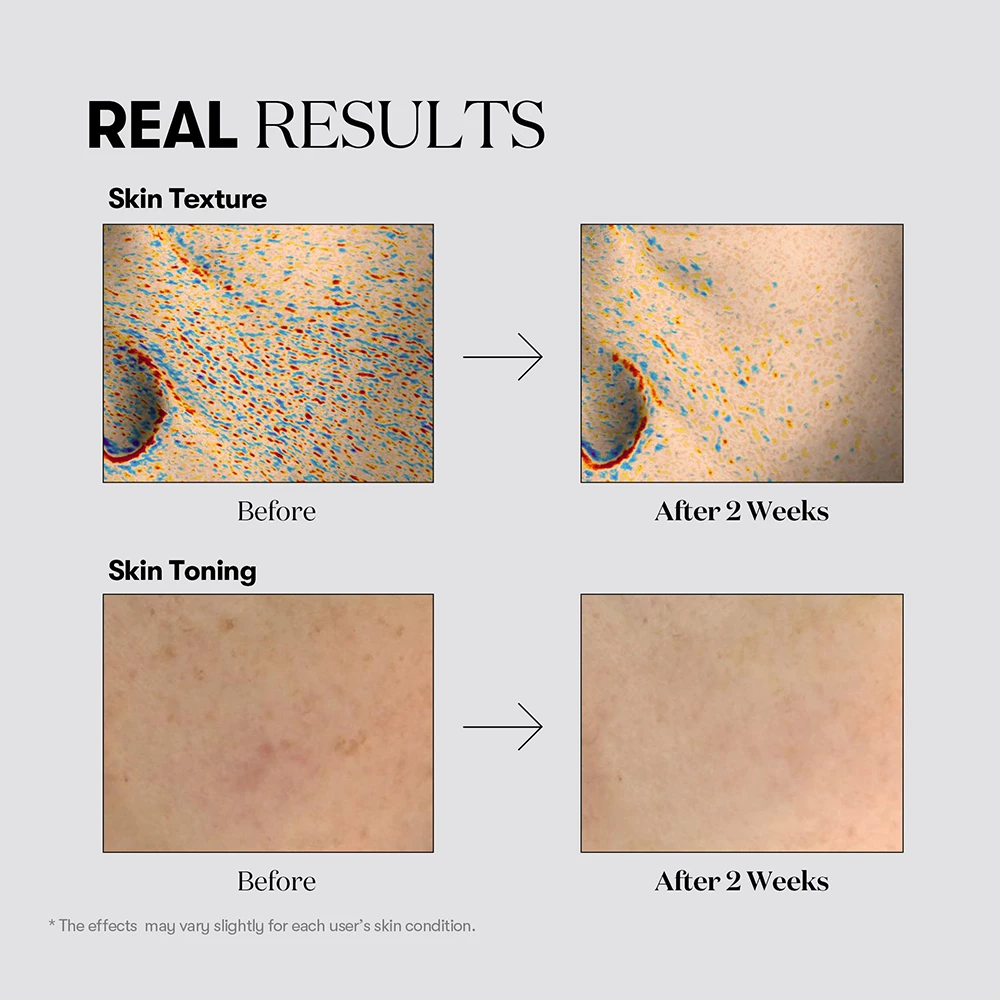 VT COSMETICS TX-Toning Daily Mask masca de fata - luminozitate si hidratare, 30 buc