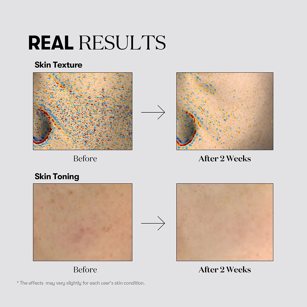 VT COSMETICS TX-Toning Essence 1000 Shot Esenta - luminozitate si hidratare, 30 ml