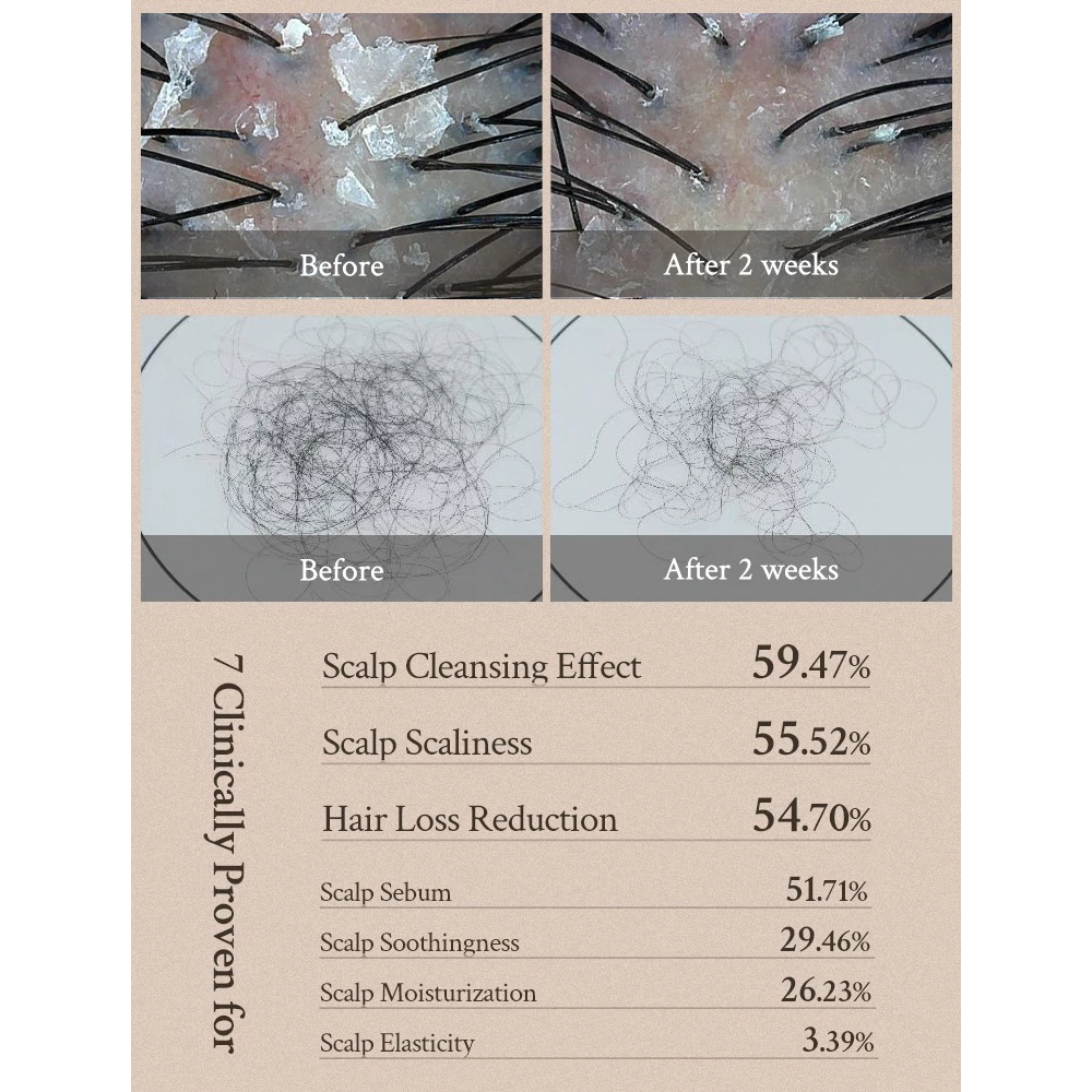 VILLAGE 11 FACTORY Vegan Deep Balance Scalp Shampoo sampon - hidratare si calmare, 300 gr