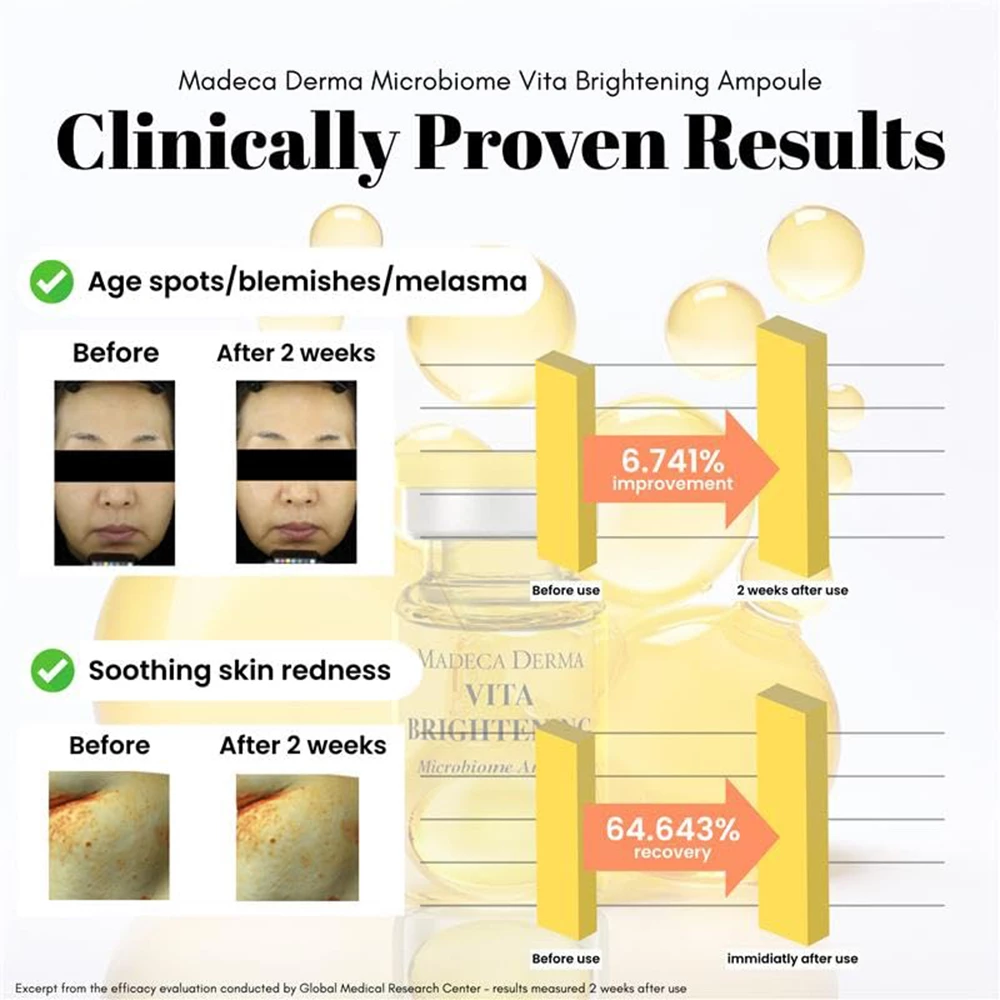 MADECA DERMA Vita Brightening Ampoule ser de fata - luminozitate si hidratare, 7 ml x 5 buc