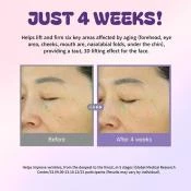 CENTELLIAN24 360 Shot Salmon PDRN Active Serum Ser de fata cu PDRN derivat din somon- hidratare si fermitate, 50 ml