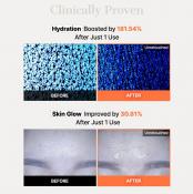 5 PDRN Hyaluronic Acid Vital Hydrating Hydrogel Mask Masca de fata 34 gr