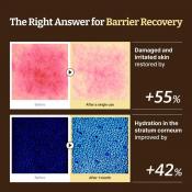 DR.REJU-ALL Advanced LC-Ceramide Barrier Cream - crema de fata formulata cu ceramide si niacinamida, care contribuie la hidratarea pielii si la metinerea confortului cutanat - 50 ml