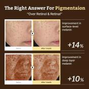 DR.REJU-ALL Advanced Retino-Mela Serum - ser de fata formulat cu Hydroxypinacolone Retinoate (HPR) si niacinamida, care contribuie la imbunatatirea luminozitatii pielii, uniformitatea tonului si textura generala - 30 ml