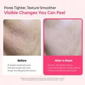 Cemenrete Cyano Pink Spicule Serum Ser de fata cu microace 30 ml