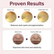 CENTELLIAN24 Expert Madeca Mela Capture Ampoule Max ser de fata - luminozitate si uniformitate, 3 x 15 ml