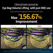 EYEPHALT Eye Bag Cream Crema contur ochi anti-cearcane 10 ml