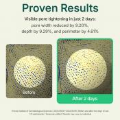 CENTELLIAN24 Madeca Powder TeaTree AC Pudra de fata - netezire si uniformizare, 6 gr