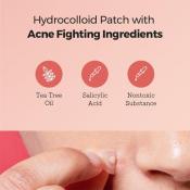 Master Patch Intensive Plasturi pentru acnee 36 buc