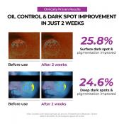 JUMISO Niacinamide 2+ Oil Control, 20 ml - Crema de fata formulata cu niacinamida si acid tranexamic, care contribuie la controlul excesului de sebum si ingrijirea imperfectiunilor