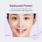 TIRTIR Niacinamide Collection Ser de fata Niacinamide 20% - Antirid, Iluminator si Uniformizare Ten, 30 ml