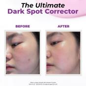 JUMISO Niacinamide 20 Serum ser pete pigmentare - luminozitate si uniformizare, 40 ml