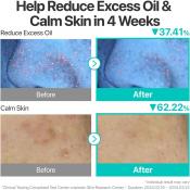 No.1 Pantothenic B5 Active Soothing Serum Ser de fata 50 ml