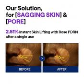 PDRN Lifting Serum Ser de fata 40 ml