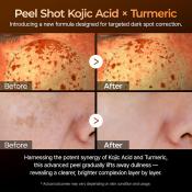 Peel Shot Exfoliating Kojic Acid Turmeric Ser de fata 80 ml