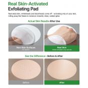 Peel Shot Exfoliating Pad Dischete exfoliante 8 buc