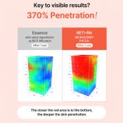 ACROPASS Reti-Rn Microcone Patch Slim Type - plasturi formulati cu retinol si PDRN, care contribuie la reducerea aspectului ridurilor si la mentinerea fermitatii pielii - 6 buc